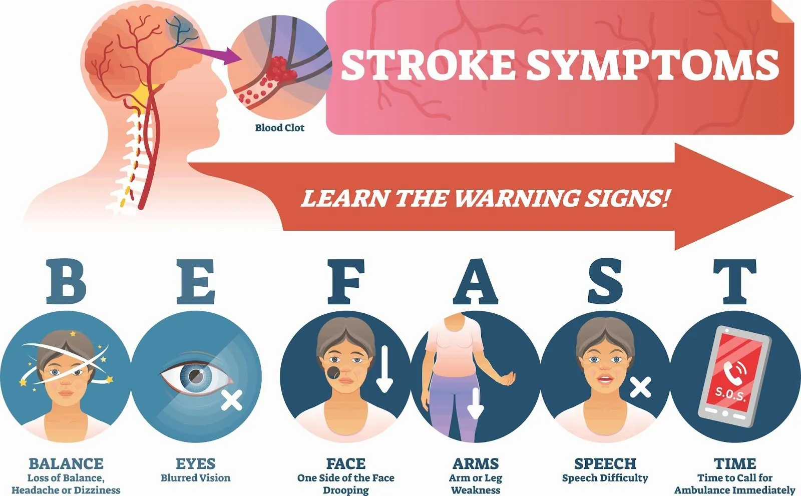 Recognising Stroke Symptoms | FAST | First Aid Training